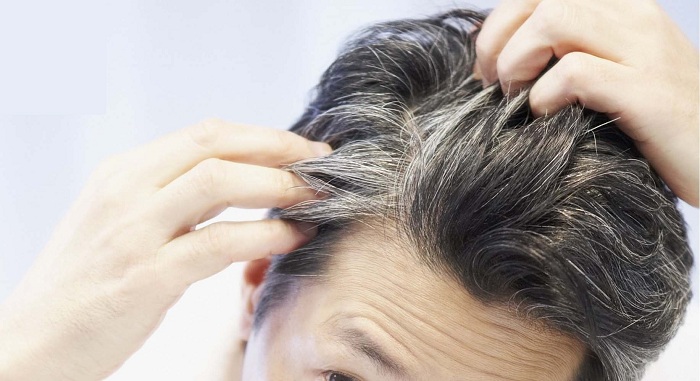 چرا موهایتان زودتر از دیگران سفید میشود؟ چرا موهایتان زودتر از دیگران سفید میشود؟