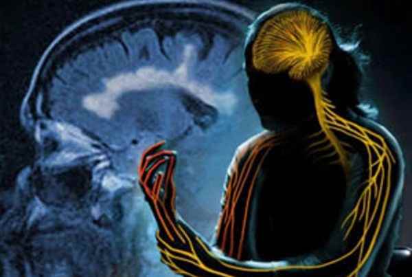 هزینه کنترل اماس ؛ ماهانه ۲ میلیون تومان هزینه کنترل اماس ؛ ماهانه ۲ میلیون تومان