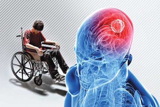 واهمه نکنید؛ «ام اس» قابل کنترل است واهمه نکنید؛ «ام اس» قابل کنترل است