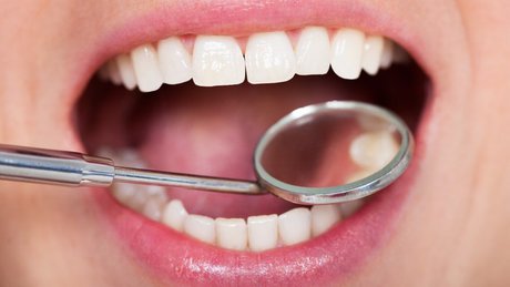 علت حساسیت دندانها چیست؟ علت حساسیت دندانها چیست؟