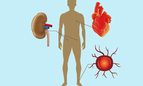عوارض دیابت کنترل نشده عوارض دیابت کنترل نشده