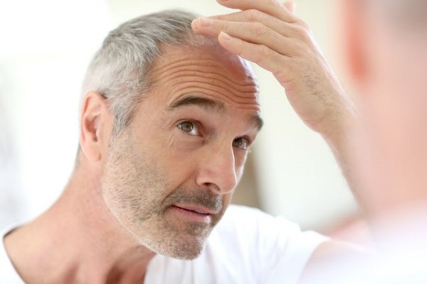 چرا ریزش مو در تابستان بیشتر میشود؟ چرا ریزش مو در تابستان بیشتر میشود؟