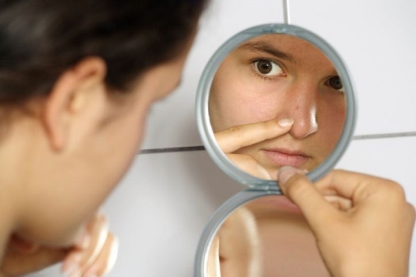 فرمولهایی ساده برای مقابله با جوش سرسیاه فرمولهایی ساده برای مقابله با جوش سرسیاه