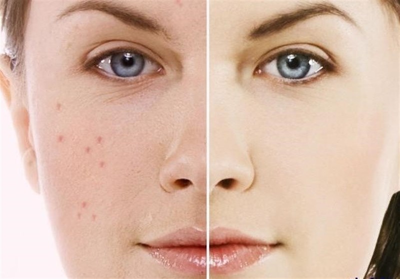 رازهای داشتن پوستی شفاف و زیبا رازهای داشتن پوستی شفاف و زیبا
