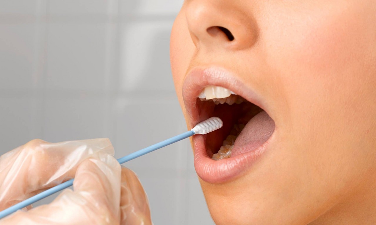 از دلایل شایع خشکی دهان از دلایل شایع خشکی دهان