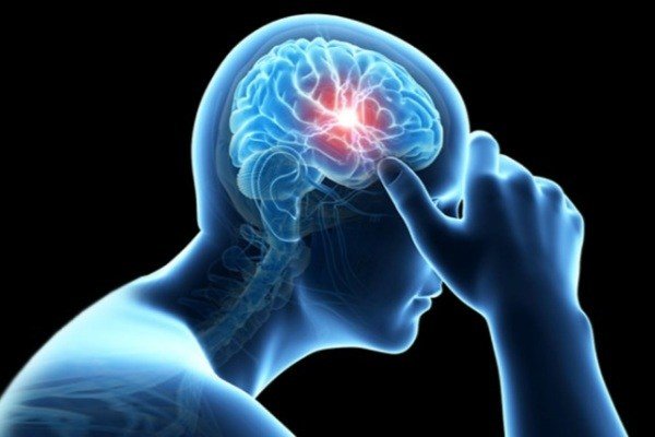 نکاتی مهم برای پیشگیری از سکته مغزی