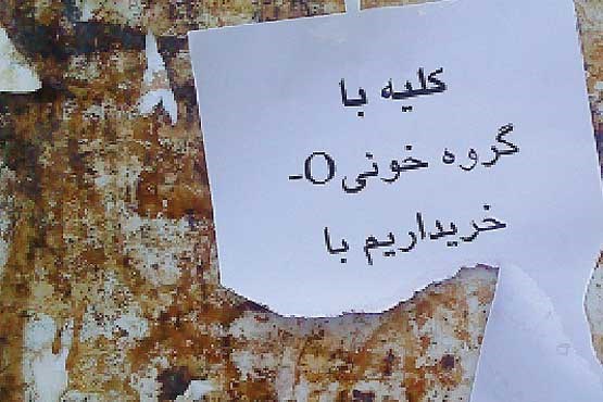 یک تکه کبد، فقط 150میلیون تومان؟! یک تکه کبد، فقط 150میلیون تومان؟!