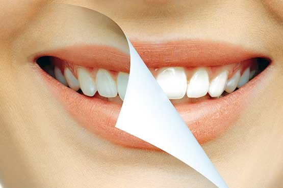 مواد خوراکی مضر برای دندانها را بشناسید مواد خوراکی مضر برای دندانها را بشناسید