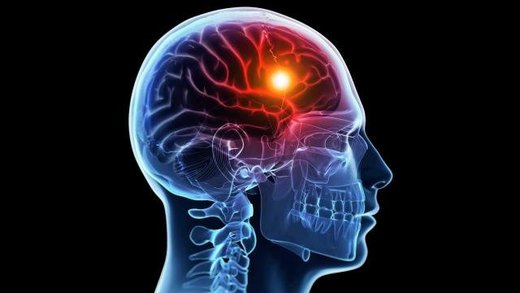 تحریک الکتریکی به تقویت حافظه کمک میکند تحریک الکتریکی به تقویت حافظه کمک میکند