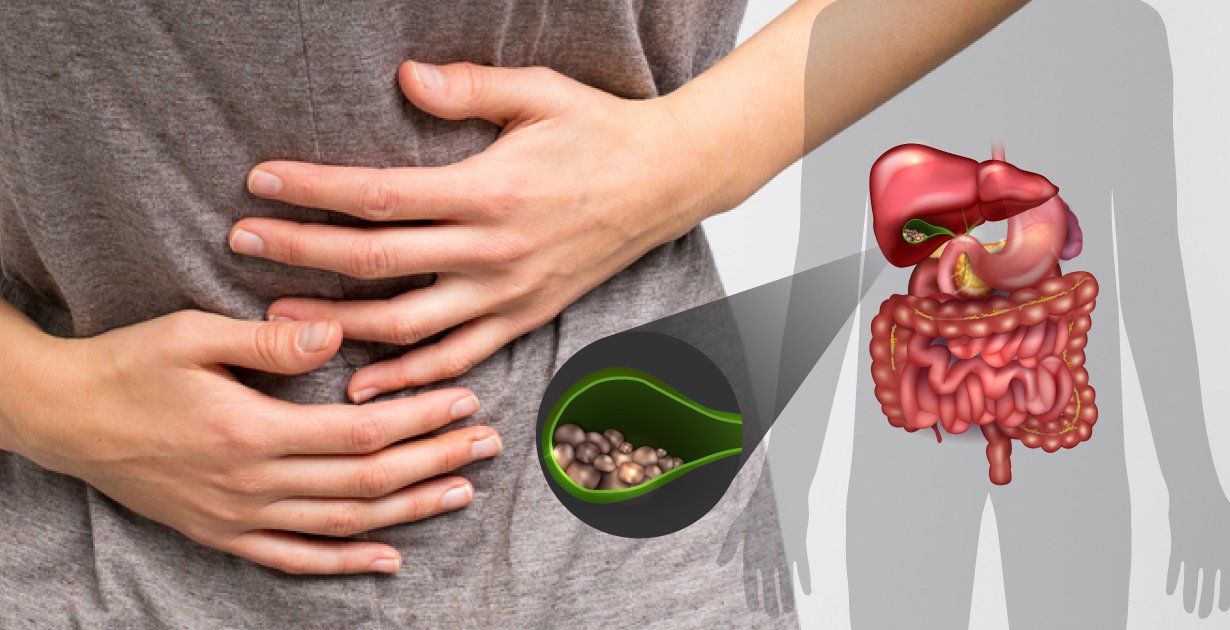 کیسه صفرا چیست و در بدن ما چه میکند؟ کیسه صفرا چیست و در بدن ما چه میکند؟ 