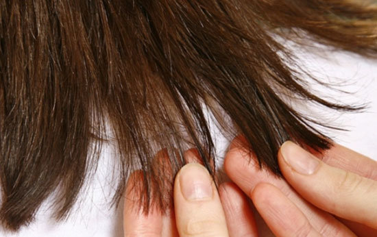 تغییرات موهای شما نشان دهنده بیماری شما است! تغییرات موهای شما نشان دهنده بیماری شما است!