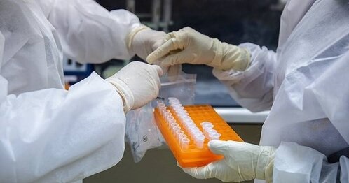 تولید کیت تشخیص ویروس کرونا در جهاد دانشگاهی تولید کیت تشخیص ویروس کرونا در جهاد دانشگاهی