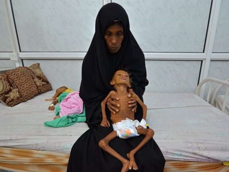 سازمان ملل نسبت به خطر گرسنگی 10میلیون یمنی هشدار داد سازمان ملل نسبت به خطر گرسنگی 10میلیون یمنی هشدار داد