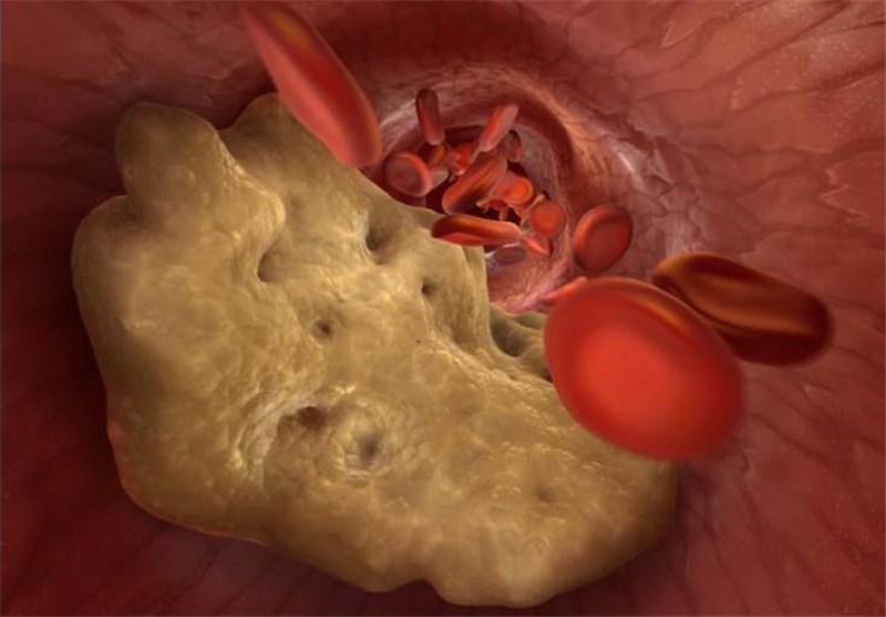 کلسترول LDL خون را با مصرف این دانه کاهش دهید کلسترول LDL خون را با مصرف این دانه کاهش دهید