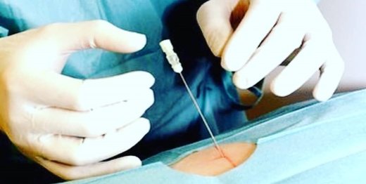 واردات دستگاه اُزنتراپی ممنوع شد واردات دستگاه اُزنتراپی ممنوع شد
