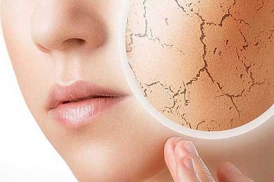 آسیبهای پوستی فصل سرد را با این ۷ماده غذایی از بین ببرید آسیبهای پوستی فصل سرد را با این ۷ماده غذایی از بین ببرید