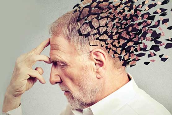 چگونه از آلزایمر جلوگیری کنیم؟ چگونه از آلزایمر جلوگیری کنیم؟