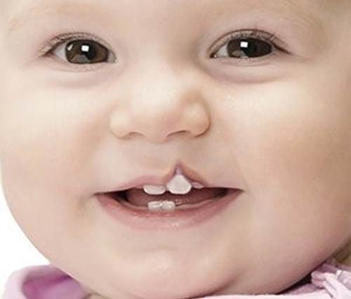 لبخند تلخ لبهای شکافخورده لبخند تلخ لبهای شکافخورده