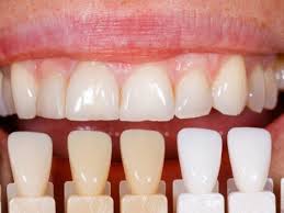 فرق لمینیت با کامپوزیت چیست؟ فرق لمینیت با کامپوزیت چیست؟