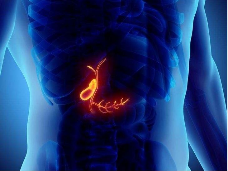 شایع ترین بیماری های کیسه صفرا چیست؟ شایع ترین بیماری های کیسه صفرا چیست؟