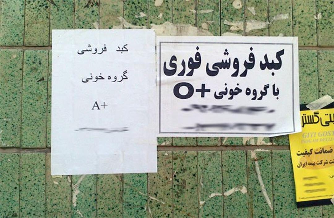 مزایده جان برای نان/ بازار پررونق خرید و فروش کبد در ایران مزایده جان برای نان/ بازار پررونق خرید و فروش کبد در ایران