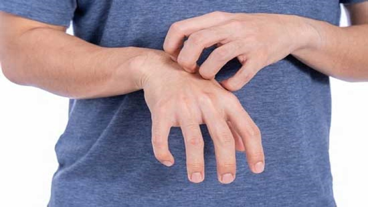تغییرات پوستی نشانه چه بیماری هایی هستند؟ تغییرات پوستی نشانه چه بیماری هایی هستند؟