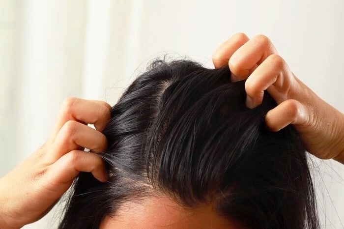 این مدل ریزش مو غیرطبیعی است؟ این مدل ریزش مو غیرطبیعی است؟