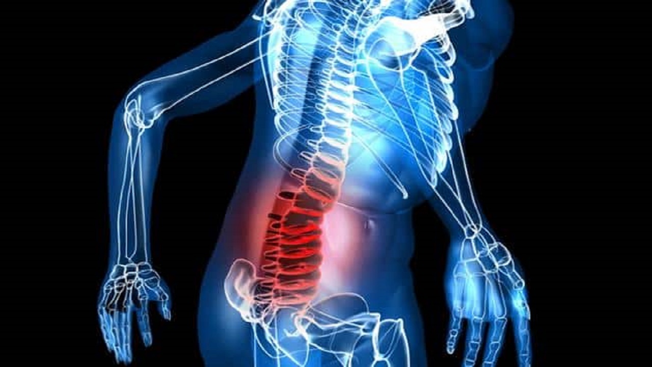 آرتروز در کدام قسمت از بدن ایجاد می شود؟ آرتروز در کدام قسمت از بدن ایجاد می شود؟