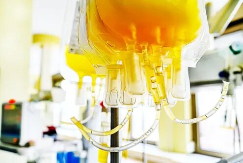 شرایط اهدا پلاسمای بهبودیافتگان کرونایی شرایط اهدا پلاسمای بهبودیافتگان کرونایی