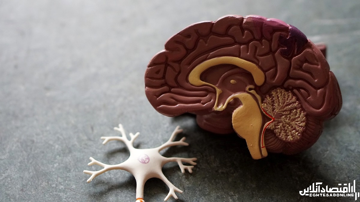 بیماری آلزایمر بیماری آلزایمر