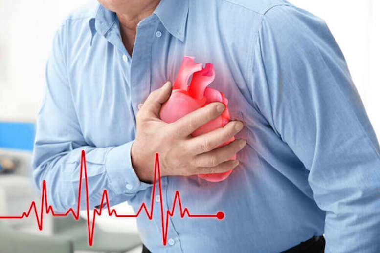 چگونه دچار تنگی عروق نشویم؟ چگونه دچار تنگی عروق نشویم؟
