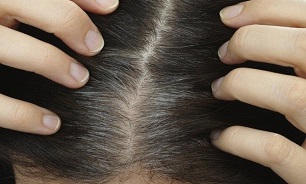 چه چیز باعث سفید شدن مو می شود؟ چه چیز باعث سفید شدن مو می شود؟