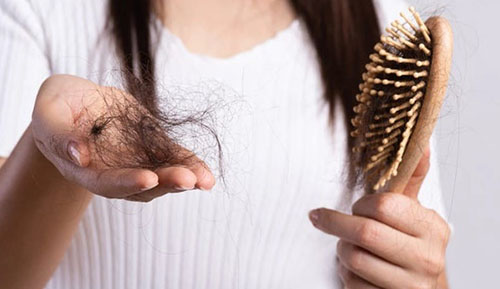 چه میزان ریزش مو نگران کننده است؟ چه میزان ریزش مو نگران کننده است؟