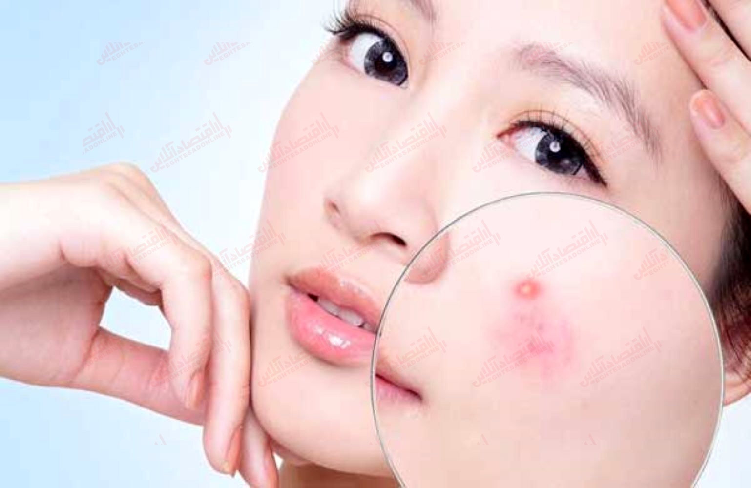 چرا جوش های کور زیرپوست شکل می گیرند؟ چرا جوش های کور زیرپوست شکل می گیرند؟