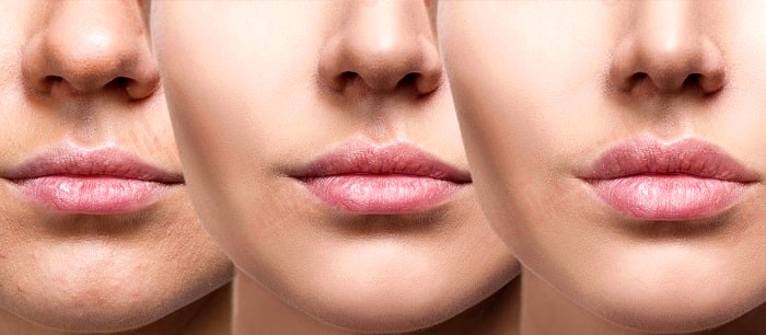 ۱۴ راه برای داشتن لب هایی سالم ۱۴ راه برای داشتن لب هایی سالم
