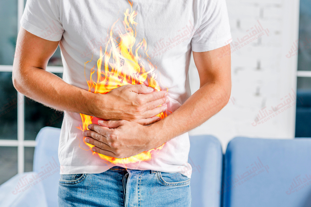 آیا استرس باعث رفلاکس اسیدی می شود؟ آیا استرس باعث رفلاکس اسیدی می شود؟