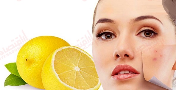 آیا لیمو جوش و آکنه را از بین میبرد؟ آیا لیمو جوش و آکنه را از بین میبرد؟