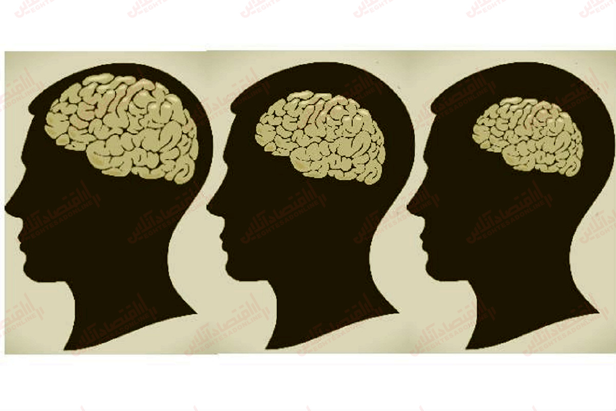 آتروفی مغزی چیست؟ آتروفی مغزی چیست؟