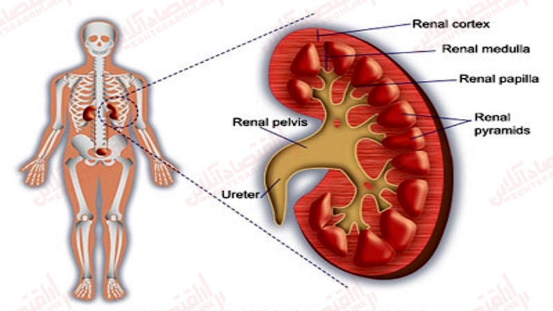 علائم بیماری نفروپتوز