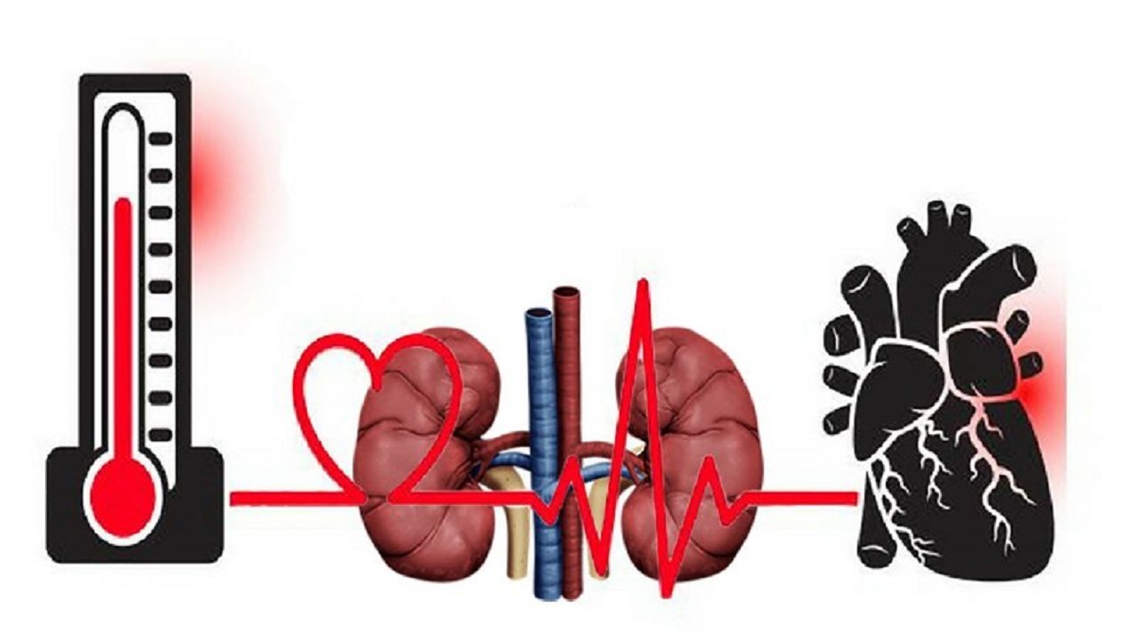 نارسایی کلیه از فشارخون بالا و کم خونی ناشی می شود