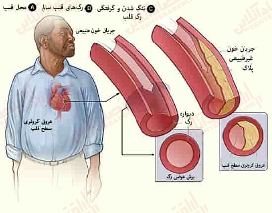 همه آنچه می خواهید در مورد پروستاگلاندین ها بدانید همه آنچه می خواهید در مورد پروستاگلاندین ها بدانید