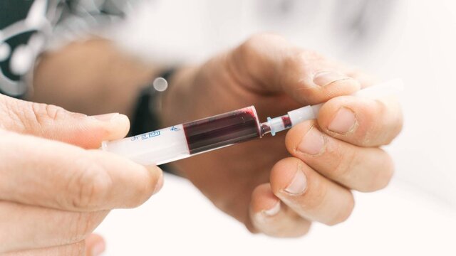 آلزایمر، فقط با یک آزمایش خون قابل تشخیص شد!