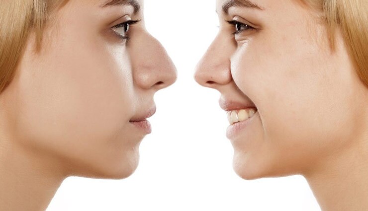 عوارض و خطرات بعد از عمل جراحی بینی