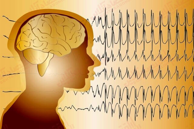 آنچه باید درباره صرع بدانید آنچه باید درباره صرع بدانید