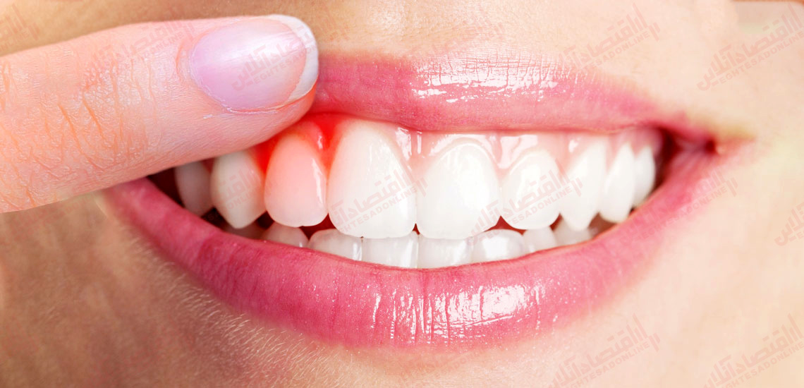 آیا درد لثه نشانه COVID-۱۹ است؟