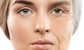 افزایش کلاژن پوست با چهار ماده غذایی افزایش کلاژن پوست با چهار ماده غذایی
