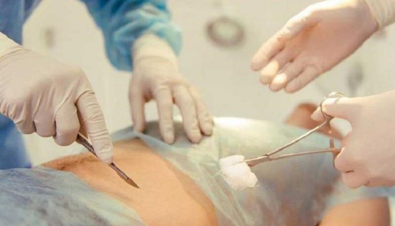 عفونت آپاندیس را چگونه تشخیص دهیم؟ عفونت آپاندیس را چگونه تشخیص دهیم؟