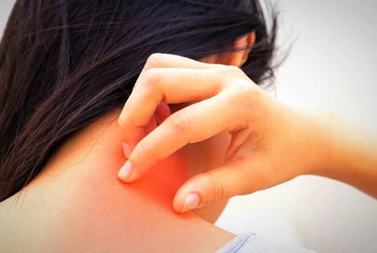 خارش بدن خبر از مشکلات کبدی می دهد خارش بدن خبر از مشکلات کبدی می دهد