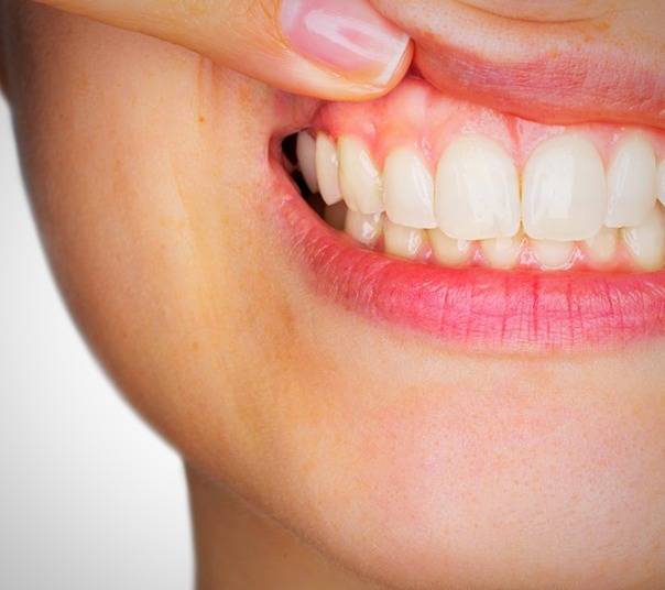 مسواک نزدن و این همه عوارض مسواک نزدن و این همه عوارض