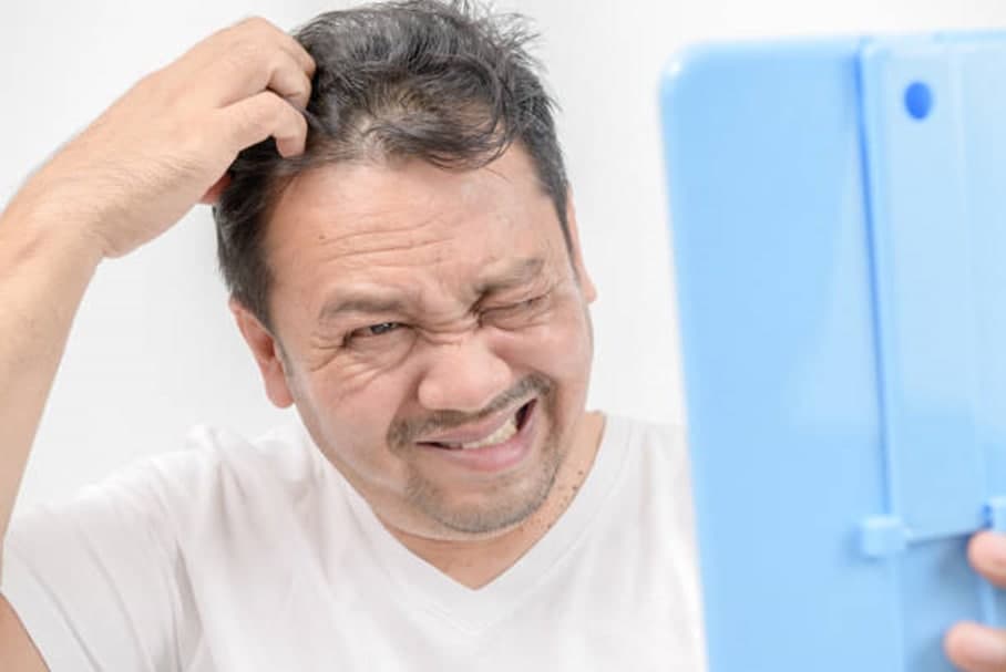 اگزمای سر چیست؟ آیا هر زخمی در پوست سر نشانه یک بیماری خطرناک است؟ ۶ + ۴ نشانه اگزما سر اگزمای سر چیست؟ آیا هر زخمی در پوست سر نشانه یک بیماری خطرناک است؟ ۶ + ۴ نشانه اگزما سر